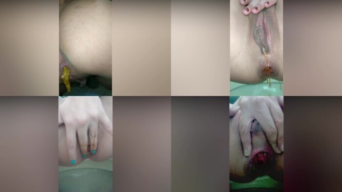 anittahotcouple – POOPING THIRTY FOUR times during TWO WEEKS!